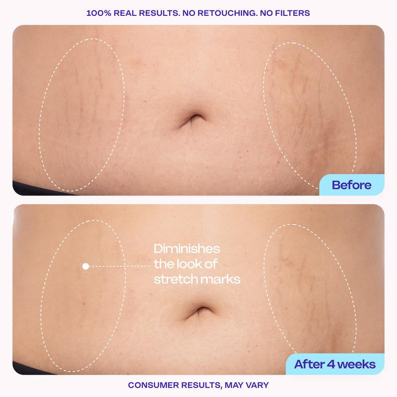 GOPURE Total Body Firming Set