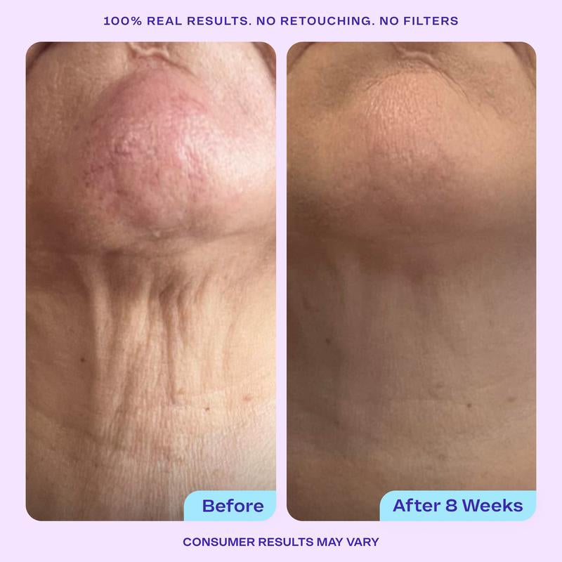 “The glow + firmness combo is crazy! My fine lines look softer and my skin feels bouncy. This is going straight into my everyday routine.”