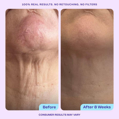 GOPURE Total Body Firming Set