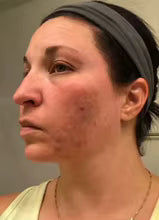 “This is my go-to skincare trio! It’s lightweight, super hydrating, and gives me that clean glass-skin glow whether I’m bare-faced or wearing makeup. My dark marks look softer, my skin feels smoother, and it just makes me look fresh every day. Highly recommend!”