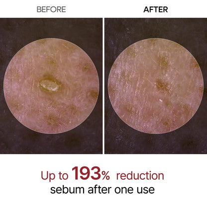 Peel Shot Glow Rice Line